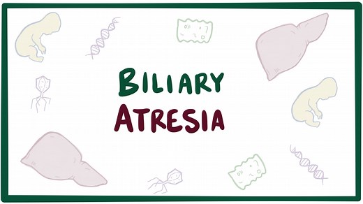 Biliary atresia: Video, Causes, & Meaning | Osmosis