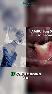 1.7K views · 29 reactions | We're revealing the secrets to effective ambu bagging to avoid critical mistakes. Discover how to optimize your technique for the best oxygenation while preventing complications. Learn the key timing for successful ventilations in emergencies! #AmbuBag #EmergencyMedicine #CPRTraining #Oxygenation #EMS #LifeSavingSkills #MedicalTraining #FirstAid #HealthcareProfessionals #RescueTechniques | CME4LIFE | Facebook