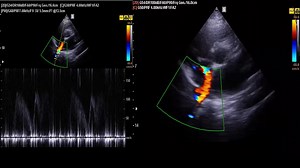 For experts, what is this structure, and how can I bring it clearly on the screen? | Hands on critical care U/S courses