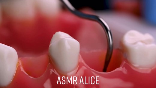 【ASMR】歯科医がインプラント治療🦷する音【ロールプレイ, 歯石除去】 #asmr #asmralice #massage #asmrchallenge
