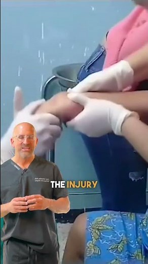 Cranking-on a Wrist Fracture #shorts