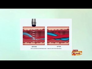 Revolutionary Approach To Treating E.D