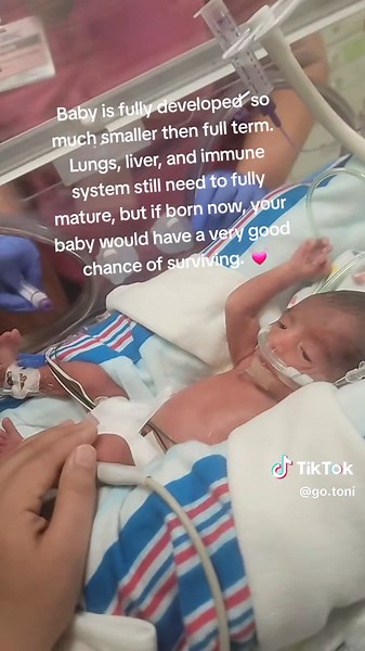 baby at 27 weeks birth. #preemie #baby #27weekspregnant #bebe #nicu #prematurebaby