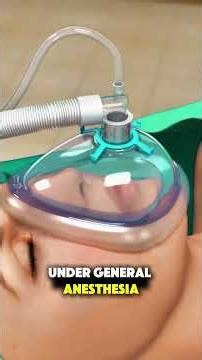 Cancer Surgery Through the Urinary Tract?! #3dmedicalanimation #aigenerated #bladdercancer #cancer