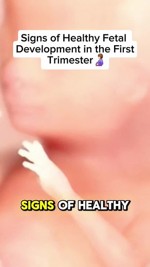 Signs of Healthy Fetal Development in First Trimester
