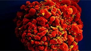 HIV cases surge in Northern Kentucky and Cincinnati