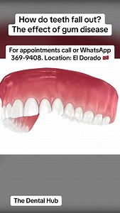 Let’s talk: Periodontal Disease #trinidaddentist #trinidadandtobago #dentist #peridontitis #gumdisease #bleedinggums #shakytooth #loosetooth #badbreath | The Dental Hub