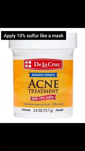Stop Squeezing Blackheads! Do This Instead