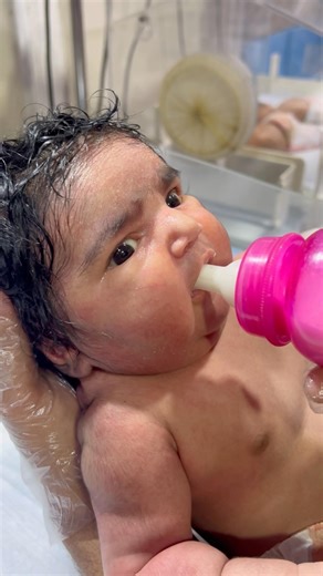 IDM Baby in Our NICU | Special Care for Infant of Diabetic Mother 💕👶 #feedingintolerance