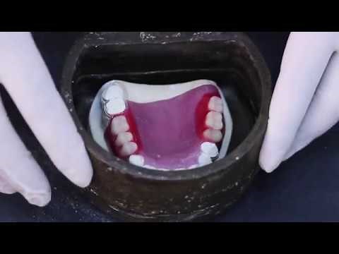 Lab # 6: Acrylic RPD Processing