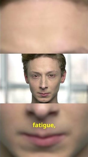 Your Eyelid Won't Stop Twitching! The Real Reason #shorts