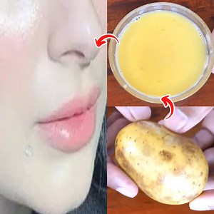 154K views · 3.4K reactions | Potato Facial Mask To Look 10 Years Younger Than Your Age || anti aging face mask | Post Beauty Tips | Facebook