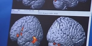 Researchers developing finger prick blood test to detect Alzheimer’s