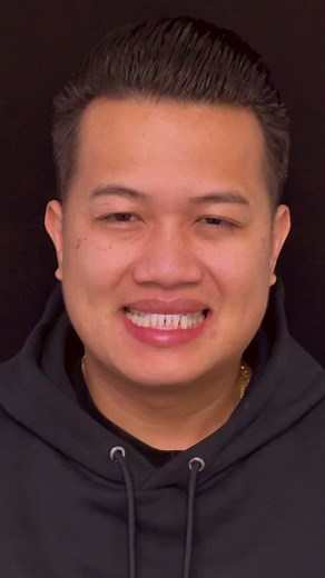 Dentures Before and After Transformation