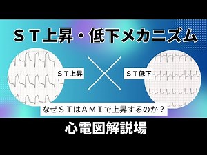 心電図解説場（虚血のST上昇、低下メカニズム）