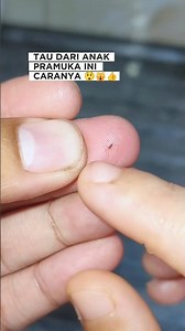 tips mengeluarkan duri atau kayu kecil dari kulit tanpa dicabut #lifehacks #tipsandtricks