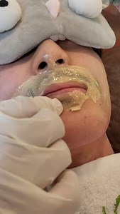 스킨스왁싱 (한국본사) on Instagram: "#얼굴왁싱 #수염왁싱 #스킨스왁싱 #facewaxing# waxing #beardwaxing #waxing #koreawaxing"