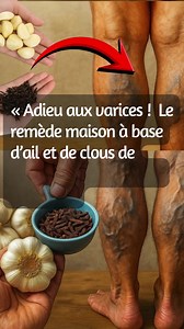 « Adieu aux varices ! 🌿 Le remède maison à base d’ail et de clous de girofle qui étonne tout le monde. Pour continuer à recevoir mes recettes, il vous suffit de dire quelque chose… Merci ! » | Recettes et Astuces facile
