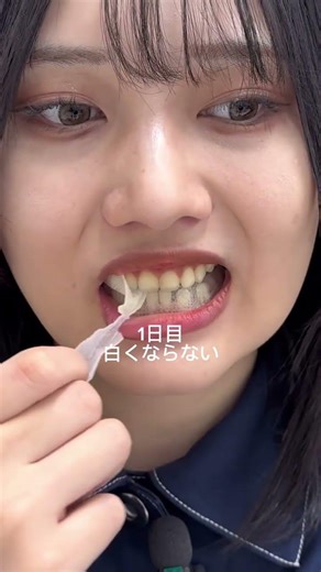ス○マなり続けても意味ない説！！最後まで見てください💪#自分磨き #ホワイトニング #歯 #美容 #正直レビュー pr