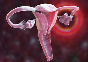 What to Do if You Get Diagnosed with an Ovarian Cyst