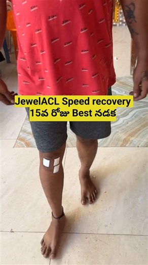 JewelACL Speed recovery 15వ రోజు Best నడక #shorts