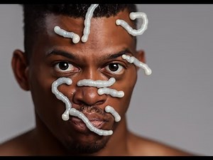 This Video Perfectly Describes the PAIN Morgellons Patients Feel 🤕