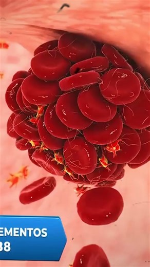 ¿Calambres, pesadez o cambios de color en la piel? Señales de trombosis y coágulos #remedioscaseros #remediosnaturales #tipsdesalud #vidasana | Doctora Jadi Landivar