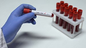 Negative Lead test, doctor showing blood sample, lab research, health checkup