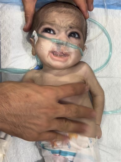 baby brain not working not responding 😭#usa #newborn #viralvideo #unfreezmyaccount