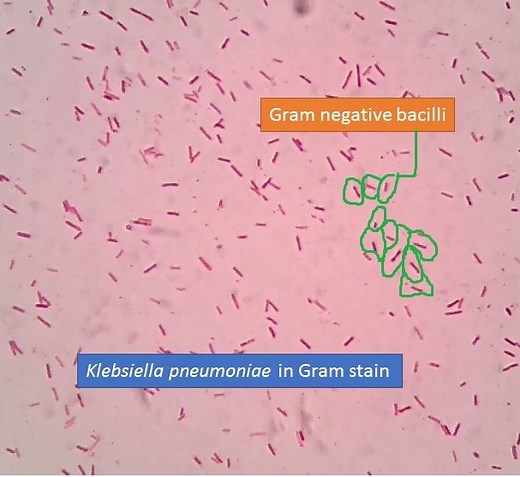 Klebsiella pneumoniae Gram stain: Introduction, Principle, Procedure