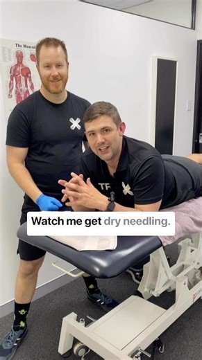 Dry needling can help tight necks. That twitch you see? That’s the magic #neckpain