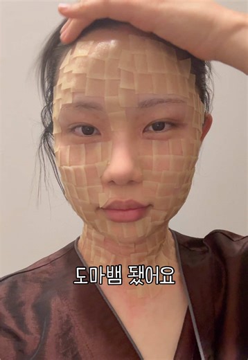 편평사마귀 제거 후기와 팁