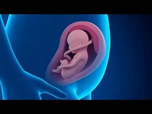 IUI intrauterine insemination | IUI procedure | How IUI works 3D animation‪@SciencebehindThings804‬