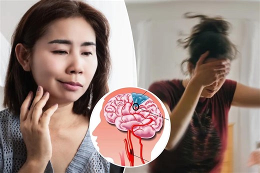 The common warning signs of a ‘mini stroke’ — and who’s most at risk