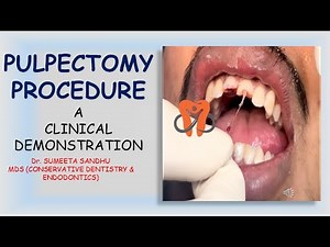 PULPECTOMY PROCEDURE CLINICAL DEMONSTRATION