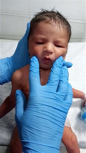 Newborn NICU Observation Care | Monitoring and Support in the First Hours of Life