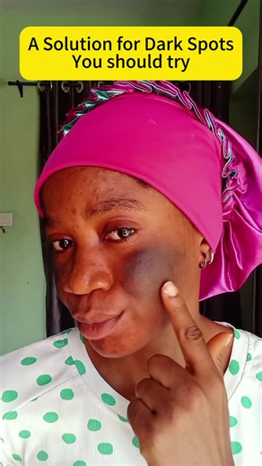 Qw Say BYE dark spots with 1 products#fyp #skincare #freckles