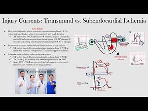 Transmural vs. Subendocardial Ischemia