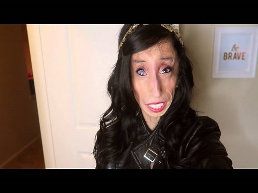 Story of woman called 'the ugliest in the world' by bullies
