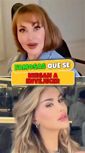 Someone tell #NinelConde she went a liiittle too far with the Botox 👀