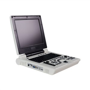 [Hot Item] Professional Laptop Ultrasonic Imaging System/ Portable Ultrasound Scanner