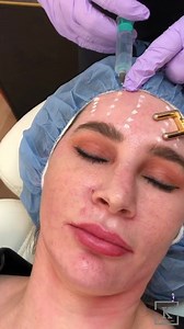 14 reactions · 5 comments | 淋THE CATEYE OF THE INSTAGRAM WORLD淋The...