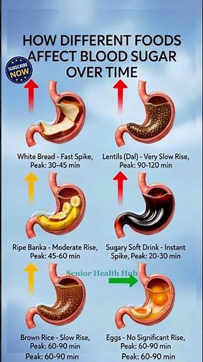 How Different Foods Spike Blood Sugar