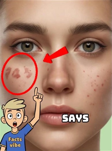 what your birthmark says about you 😱 #facts