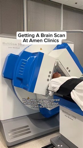 Amen Clinics on Instagram: "Many of you have been asking... what is a SPECT scan? It’s a brain imaging tool that shows blood flow and activity, helping our doctors diagnose more accurately and personalize treatment. To make this possible, a safe, tiny amount of isotope (similar to a CT scan) is given during a cognitive assessment. Why then? Because it captures the brain while it’s working. Then it’s scan time. The key? Stillness. Brian used his 20 minutes to sneak in a quick catnap — no movement
