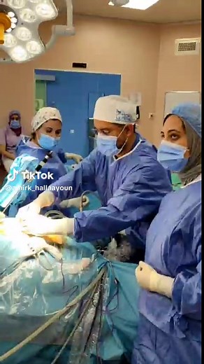 Access ports or trocars allow us to introduce small instruments to perform any type of surgery in natural or artificial cavities of the body, they are generally less than 10mm. and are imperceptible over time in addition to providing less post-surgical pain compared to open surgery. #sleeve #biparticiongastrica #bariatricsurgery #endosurgery #gastroendobariatrique #cirmeob #maroc🇲🇦 #mexico🇲🇽 #obesidad #sobrepeso #perderpeso #perdredupoids