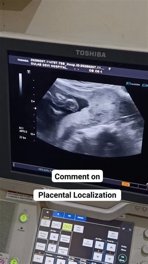 Comment on Placental Localization.... #masteringultrasound #ultrasoundscan #radiology #sonography #india #indian #Bangladesh #Peshawar #Multan #dradnannawaz | Mastering Ultrasound