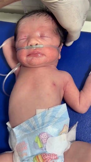 Newborn Baby with RDS – Watch This Little Fighter!
