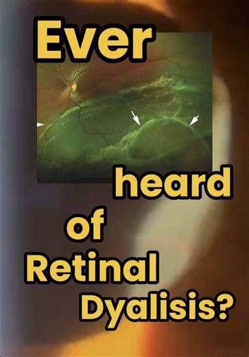 The Importance of Routine Eye Checks: A Case Study