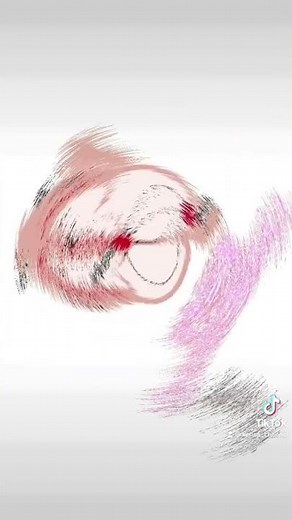 【心電図】不完全右脚ブロックが進行すると... 【ECG】If the incomplete right bundle branch block progresses...